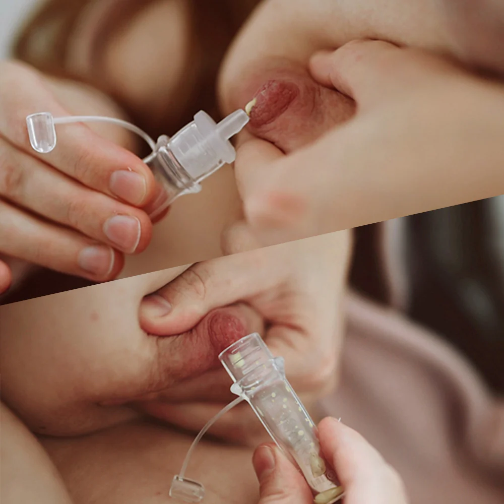Colostrum Collector for Antenatal Expressing & Newborn Feeding - Image 3